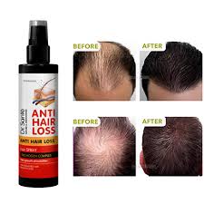 Dr Santé Spray anti hair loss 150ml